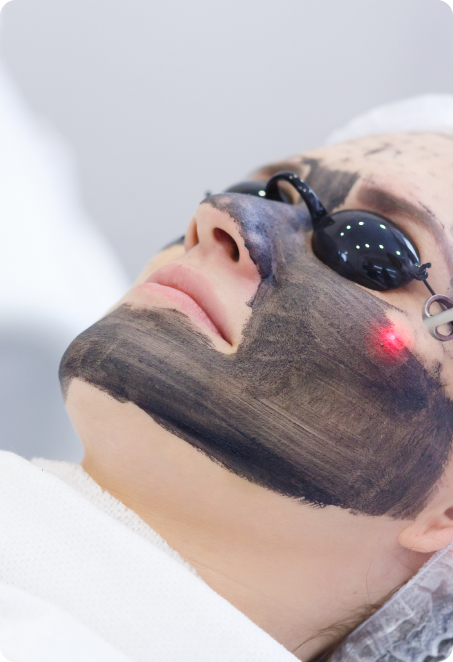 Laser Skin Rejuvenation Facial - Carbon Peel, Hollywood Facial